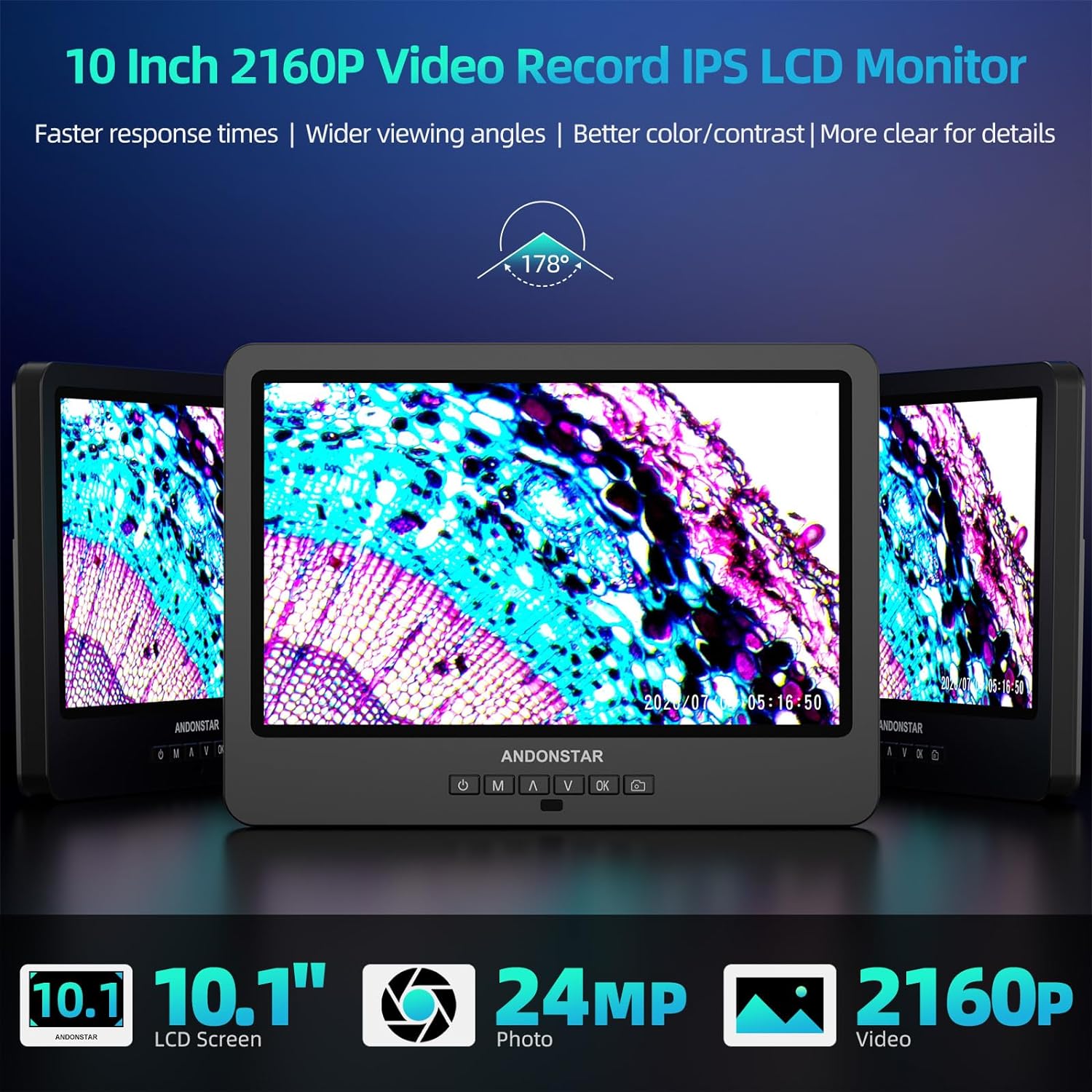 Andonstar AD269S Mikroskop Kinder HDMI 5 Objektive Bio Labor